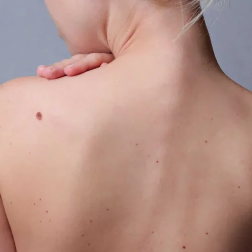 imgi_2_Comprehensive_Health_Assessments_1